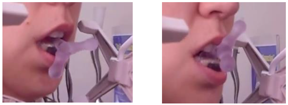 Fisioterapia ATM 4