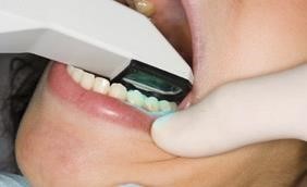 Impronta ottica