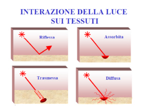 Laser dentale