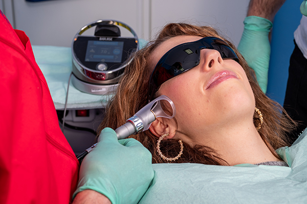 Sbincamento laser