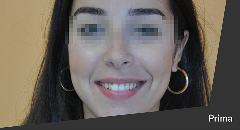 Caso 13